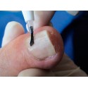 Aplicar podoprimer sobre las uñas