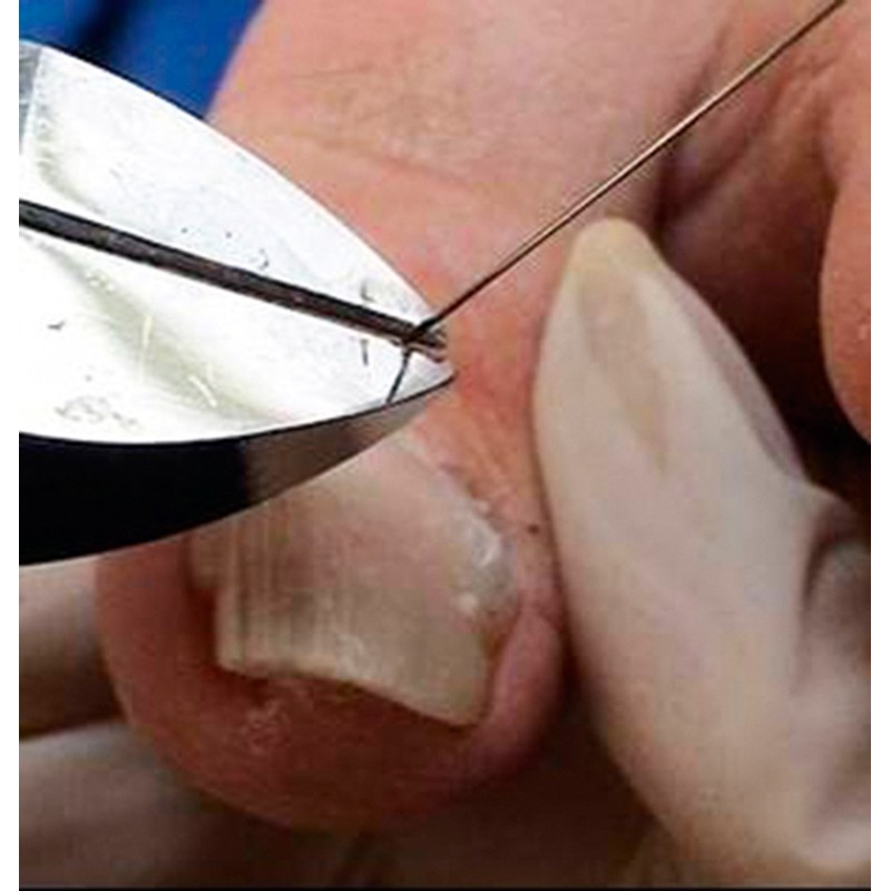 Alicates para alambre de titanio con filos oblicuos, Podiatech
