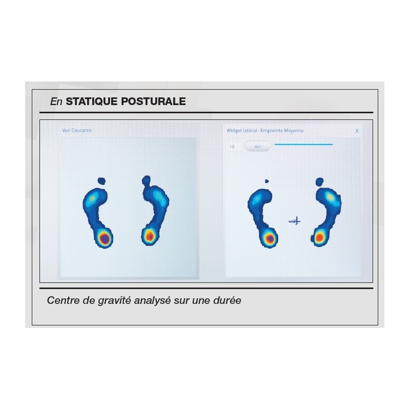 software pressmat informe