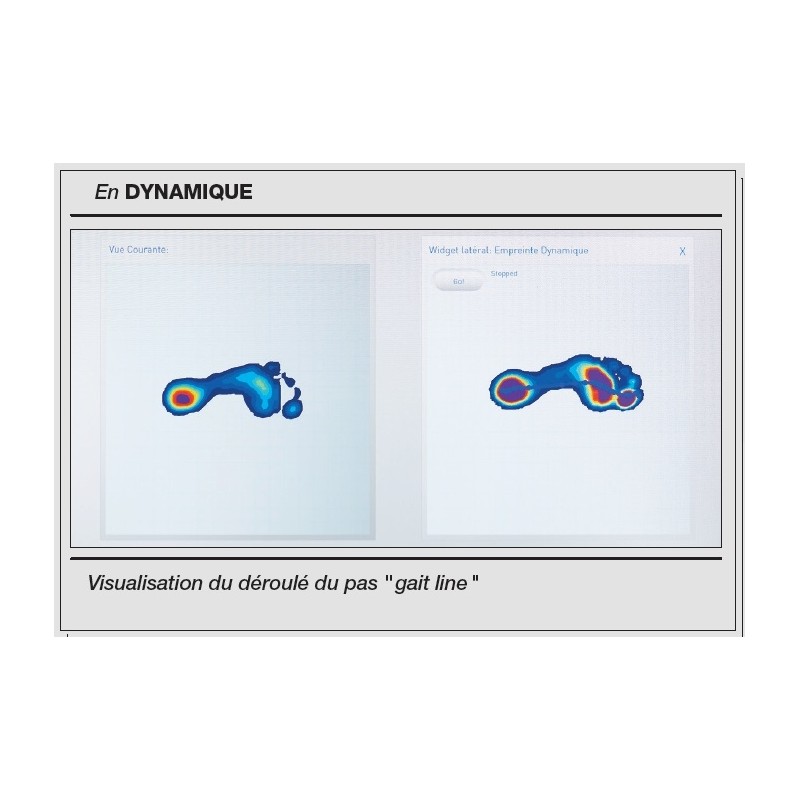 software pressmat análisis dinámico