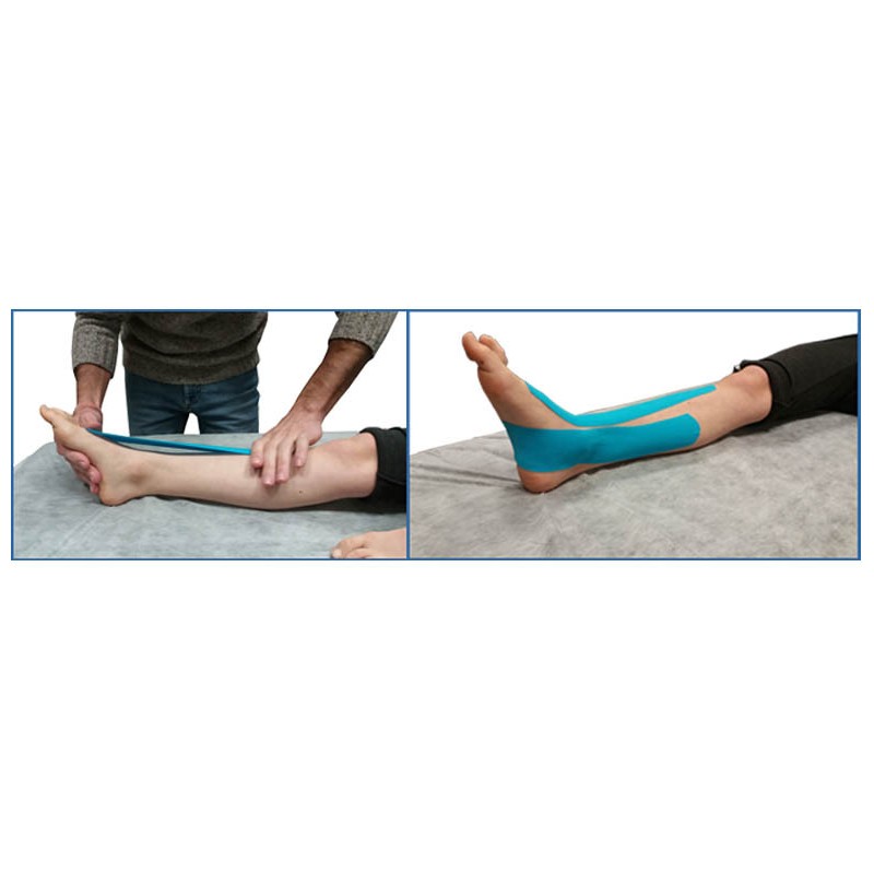 Vendaje Neuromuscular